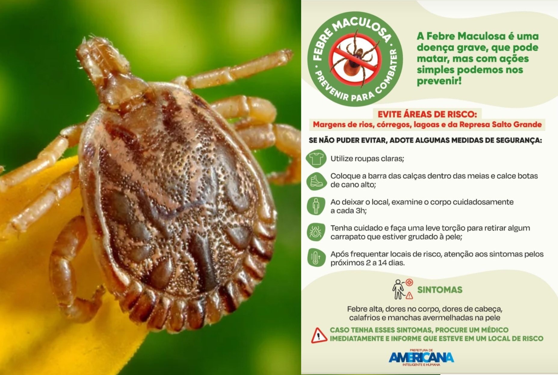 Morte de moradora de Americana infectada em Limeira por febre maculosa é confirmada