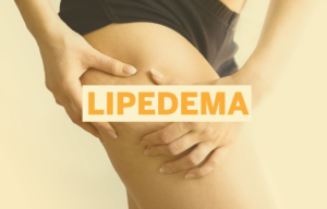 LIPEDEMA-1-300x192 Vai Vendo Brasil Portal de Notícias