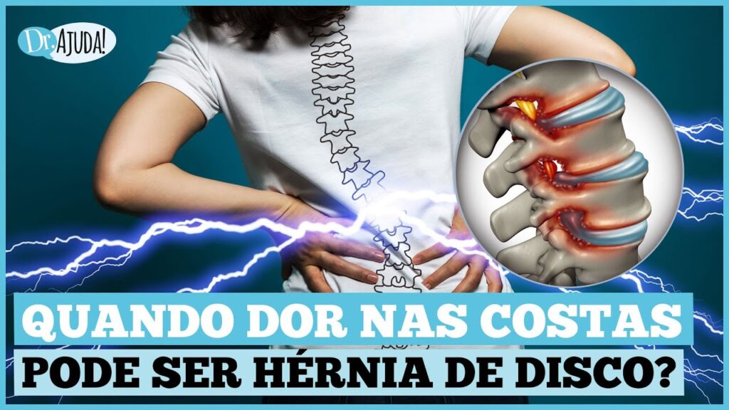 hernia-de-disco-1024x576 Hérnia de disco: Quando suspeitar? Qual o diagnóstico e o tratamento?