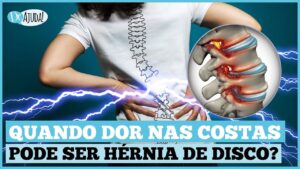hernia-de-disco-300x169 Vai Vendo Brasil Portal de Notícias