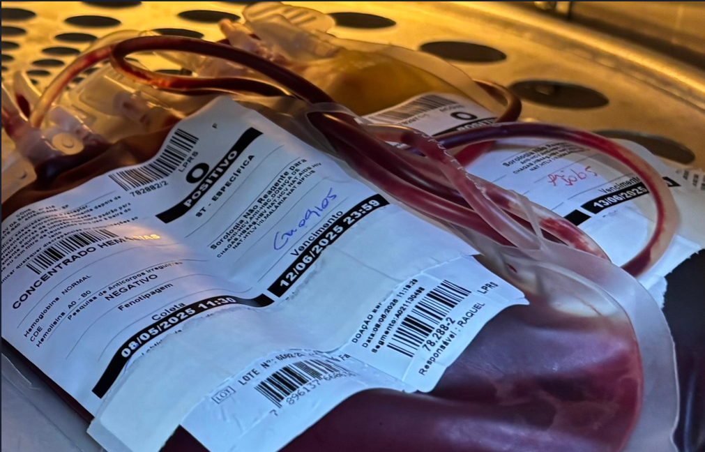 Bolsa-de-sangue Banco de Sangue do HM de Americana precisa urgente de doações de sangue O negativo