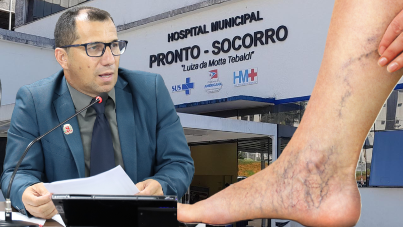 Falta de cirurgiões vasculares no Hospital Municipal preocupa vereador em Americana