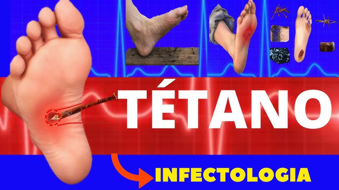 hq720 Tétano: por que vacinar?