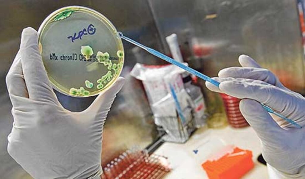 kpc-bacteria-1024x602 Hospital de Americana isola UTI após caso de superbactéria KPC