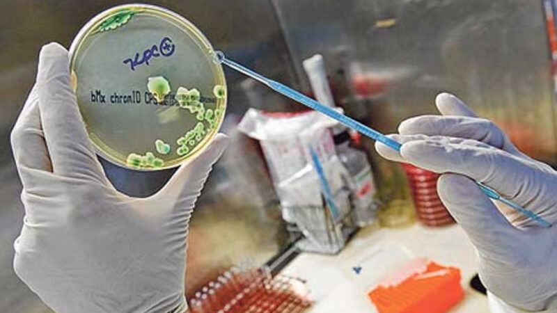 Hospital de Americana isola UTI após caso de superbactéria KPC